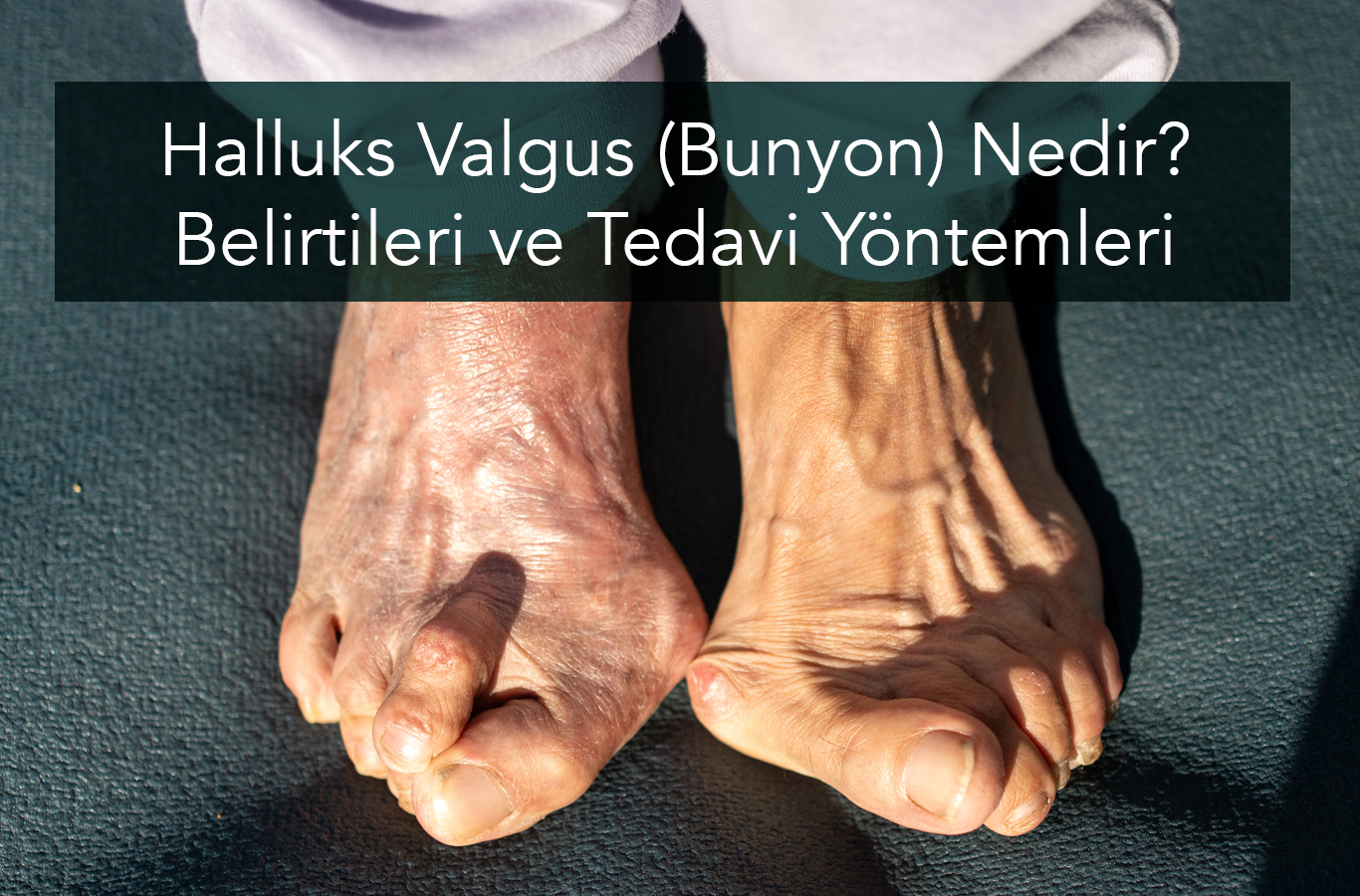Baş Parmak Neden İçe Döner?